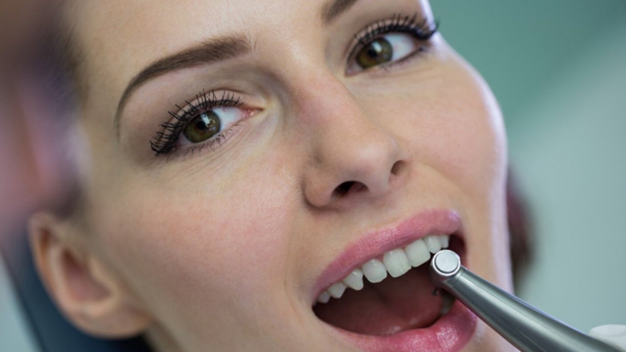 zirkonyum-yaptırdım-pişmanım