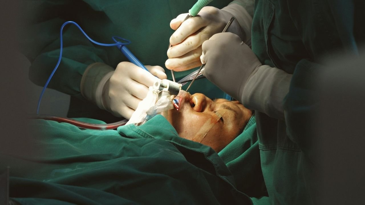 2 – Cerrahi Müdahaleye Bağlı Travma