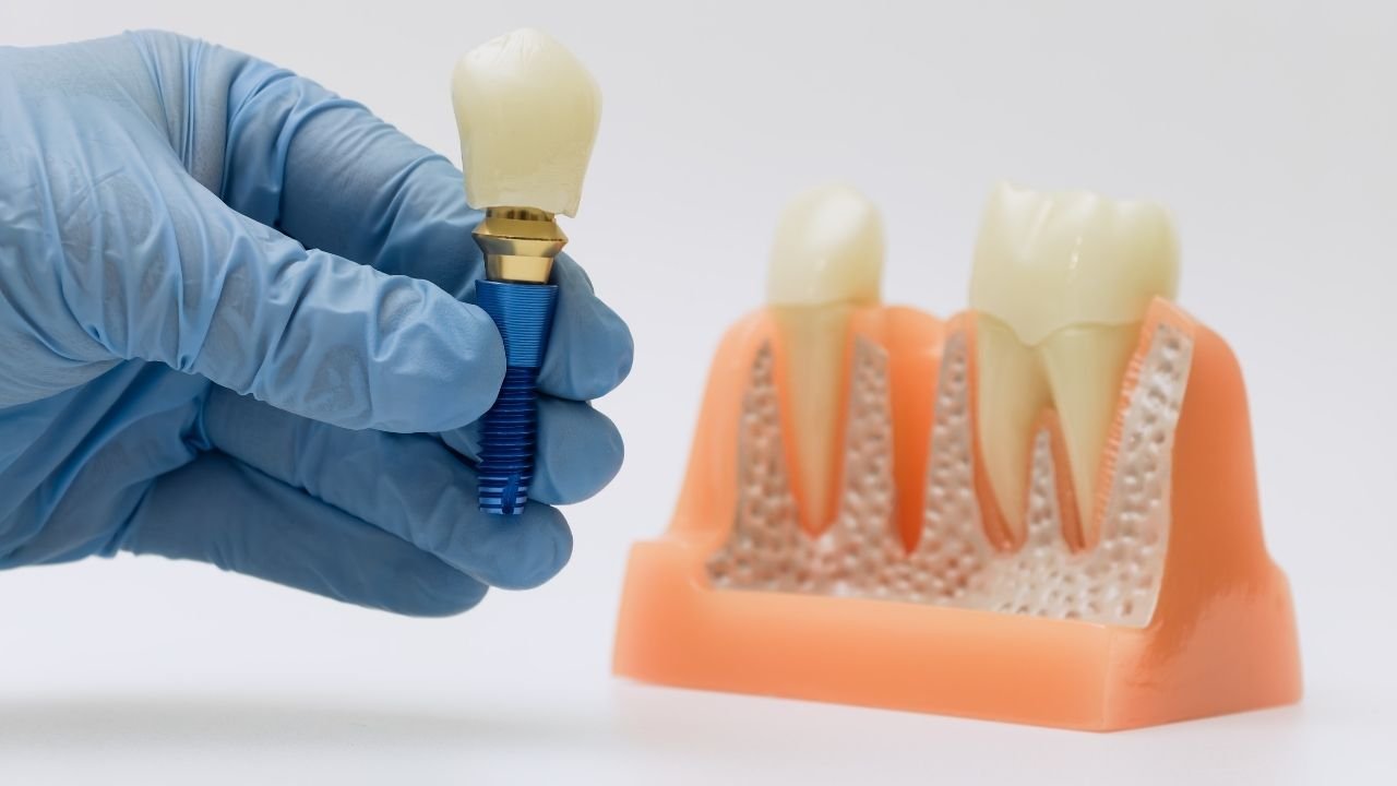 İmplant Sonrası Şişlik Geçmezse Ne Yapılmalı?