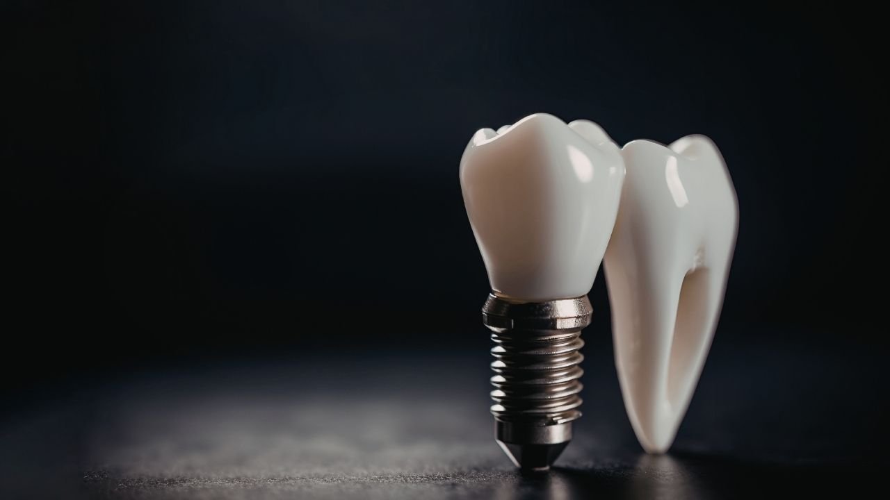 İmplant Sonrası Yüz Şişmesi Neden Olur?